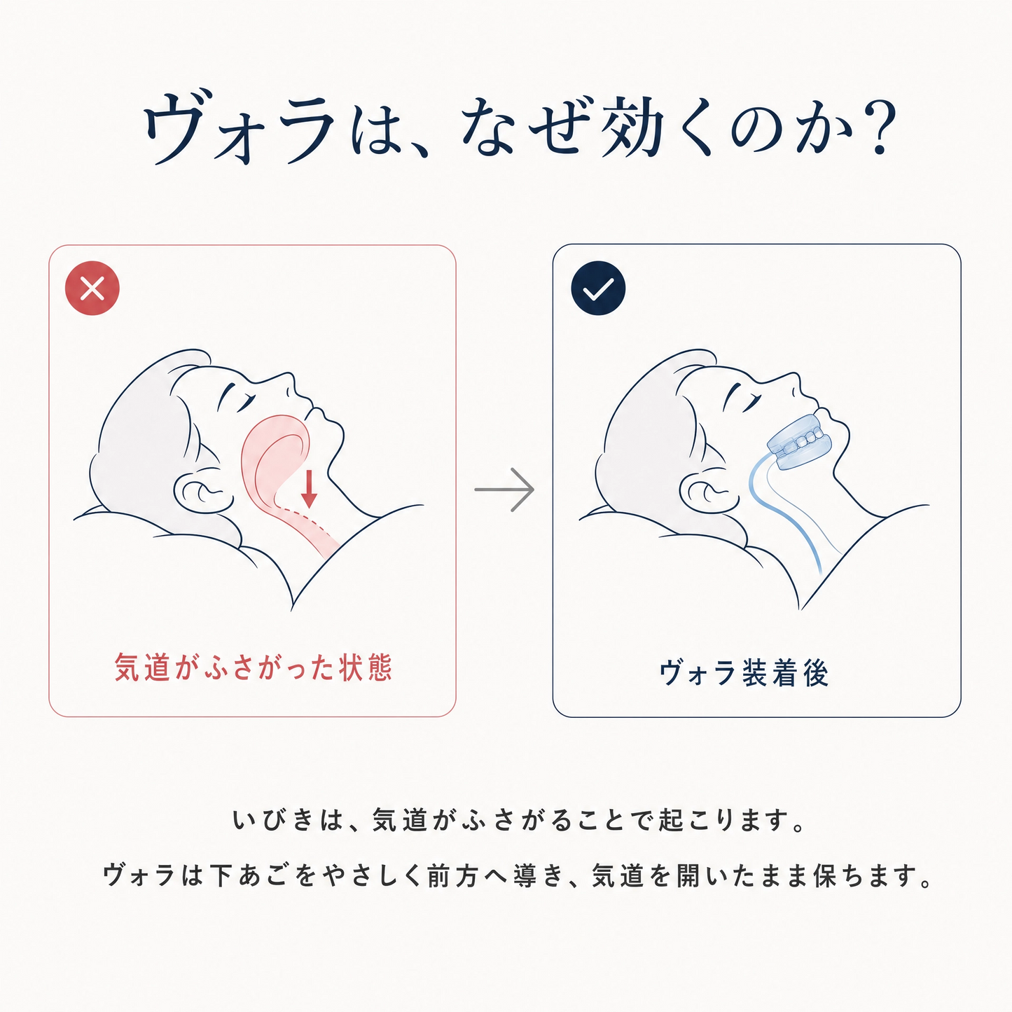 ヴォラ™︎マイスピース