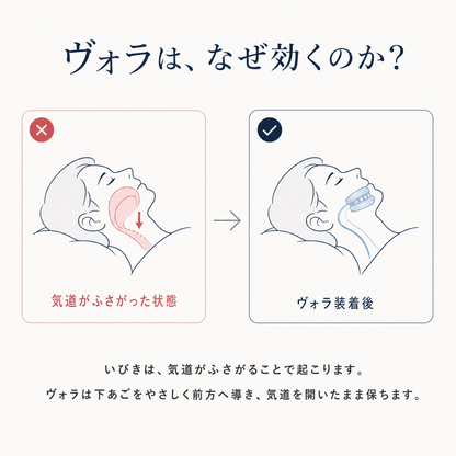 ヴォラ™︎マイスピース